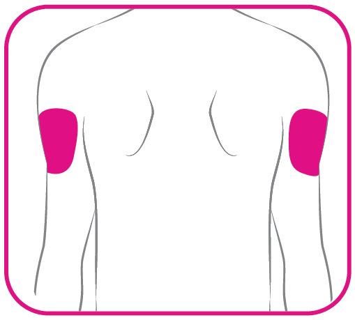 tresibaicon1